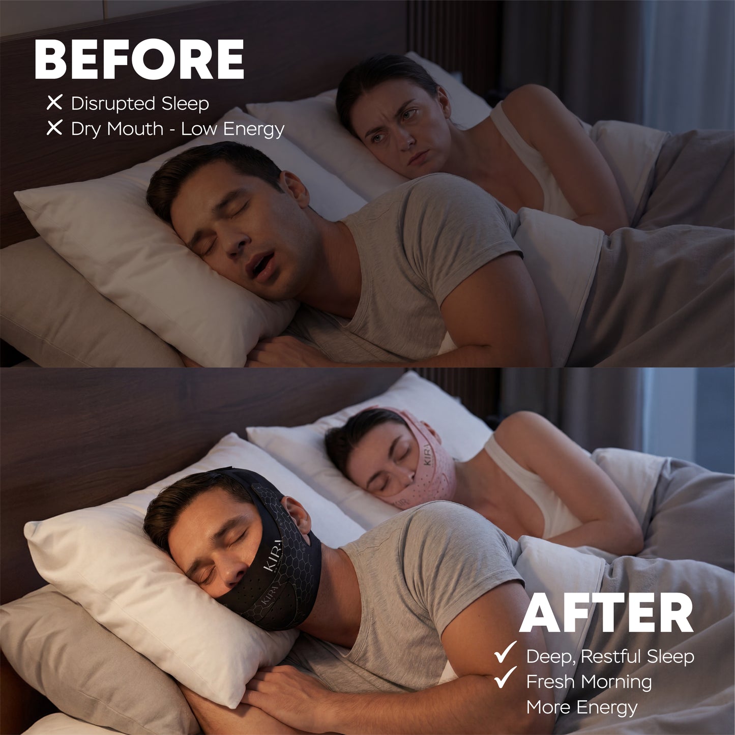 KOGAO V-LIFT PRO FACE STRAP FOR SNORING