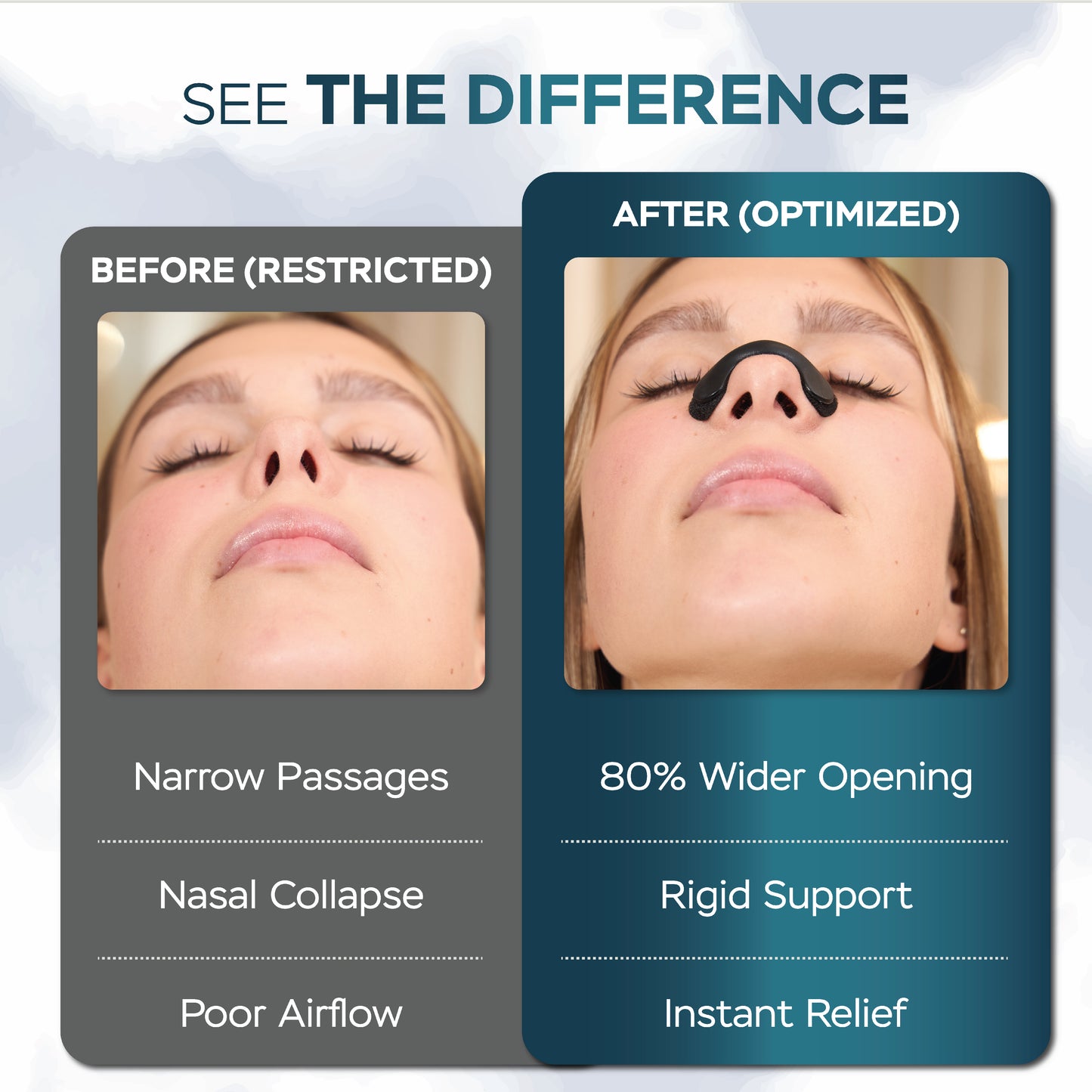 KIRA BrEASY Velcro Nasal Dilator